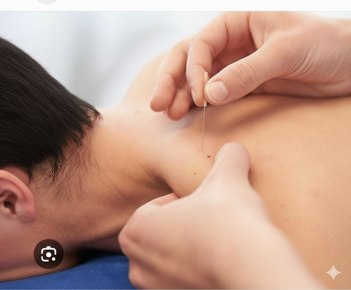IMS/Dry Needling